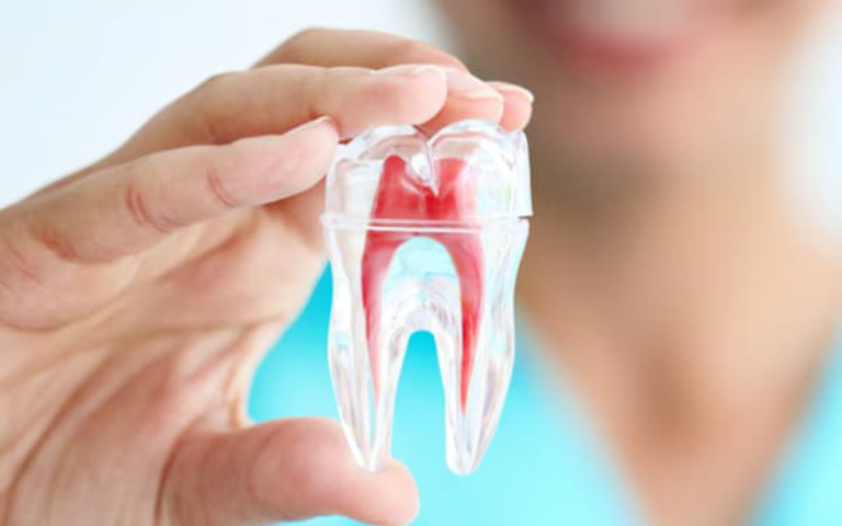 Tooth Extractions