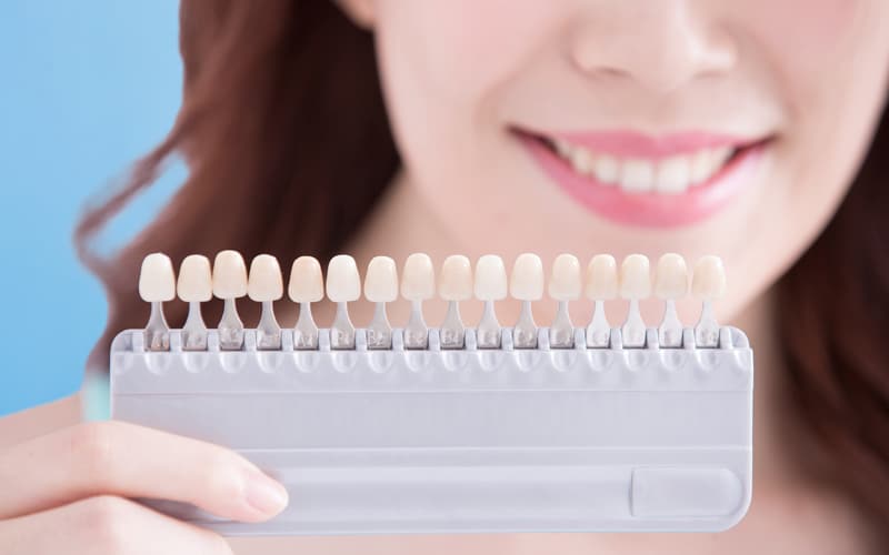 porcelain veneers near you