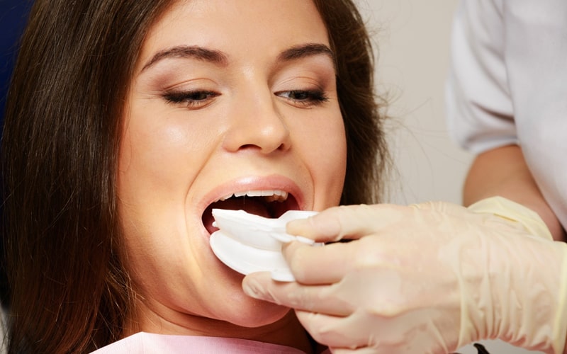 teeth whitening near you