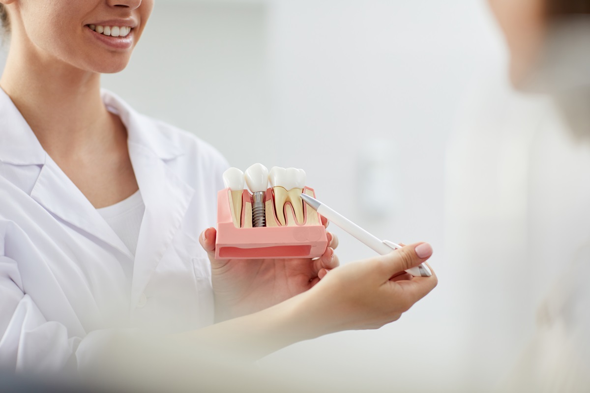 dental implants a revolutionary smile treatment