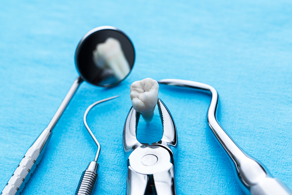 recovering after a tooth extraction helpful tips