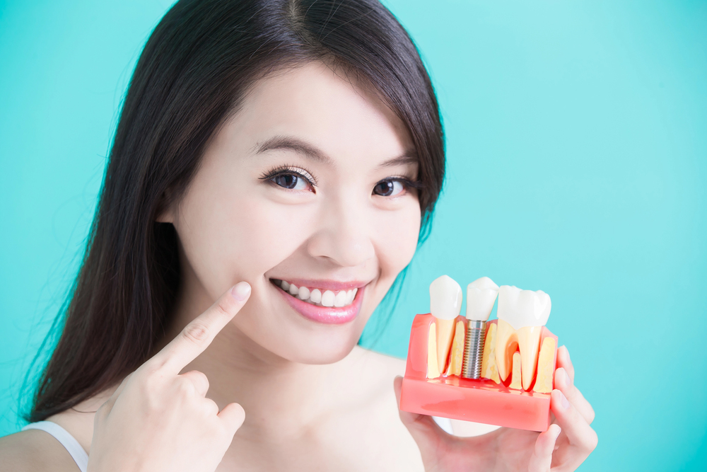 Dental Implants in Livonia