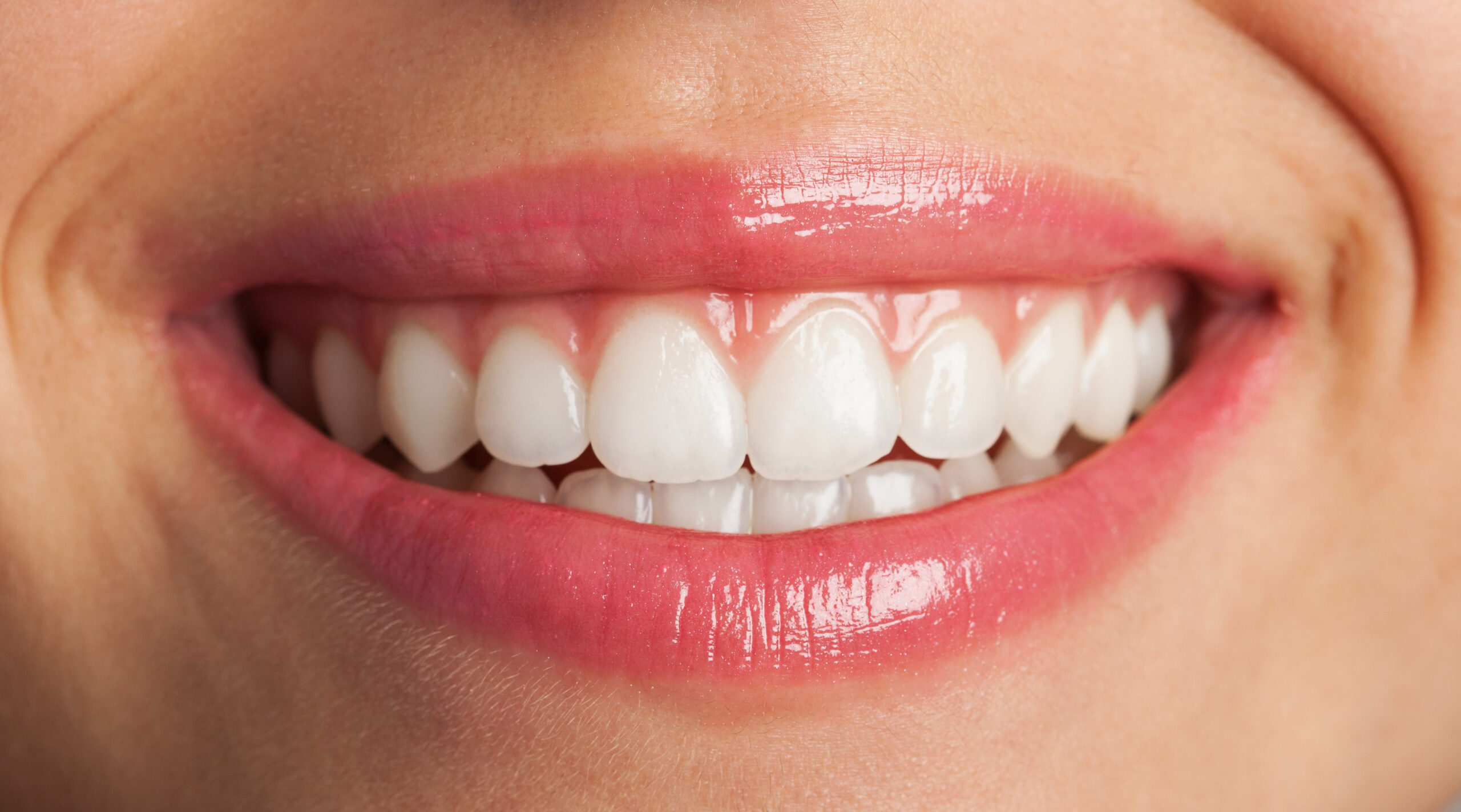 how to maintain your white smile long term
